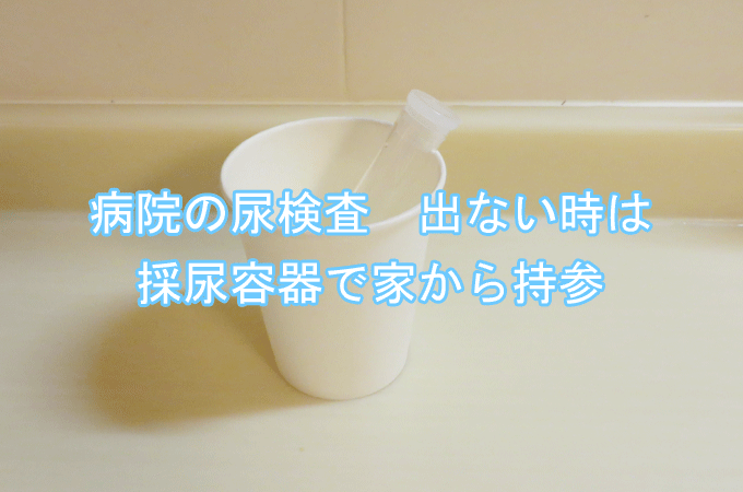 検尿のカップと容器